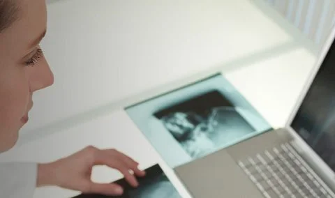 female looking at x-rays on laptop