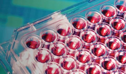 rack of small test tubes containing red blood